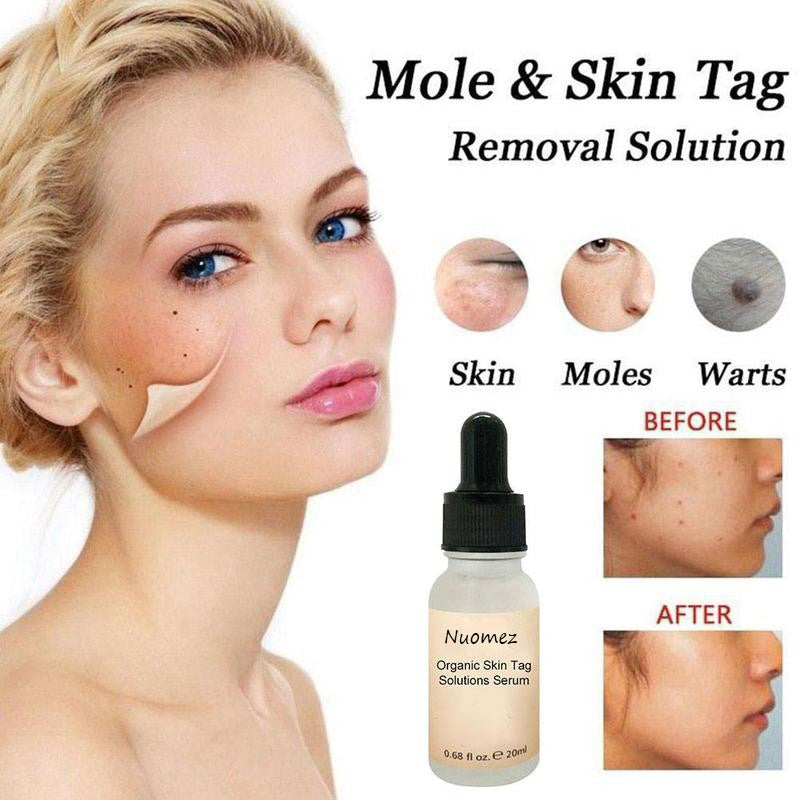All Natural Skin Tag Remover Serum