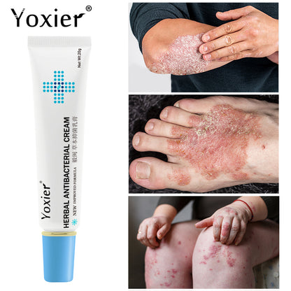 Herbal Antibacterial Cream Psoriasis Cream Anti-itch Relief Eczema Skin Rash Urticaria Desquamation Treatment